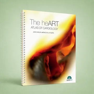 Cover of The HeART